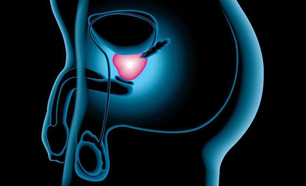 Read more about the article Verdades sobre el cáncer de próstata en República Dominicana